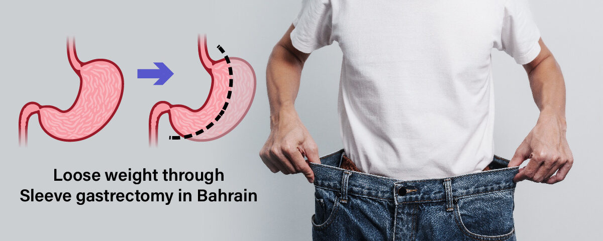 Sleeve Gastrectomy in Bahrain | Alsalam Specialist Hospital