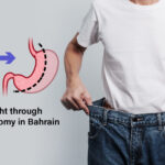 Sleeve Gastrectomy in Bahrain | Alsalam Specialist Hospital